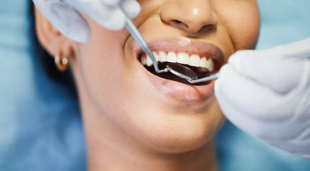 Best Emergency Denture Repair in Elgin, OR